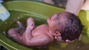 Sap-vernix-caseosa-tren-da-tre-so-sinh-4
