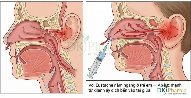 Sai lầm khi vệ sinh mũi cho trẻ